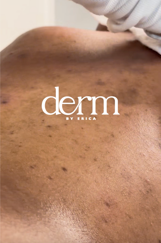 Water and Wellness: How Hydration Boosts Your Glow from Within